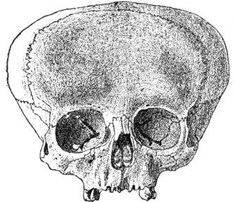aymara-skull2.jpg